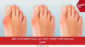 ورم إبهام القدم “الوكعة”: تعرف على أسبابه الخفية وأحدث طرق العلاج